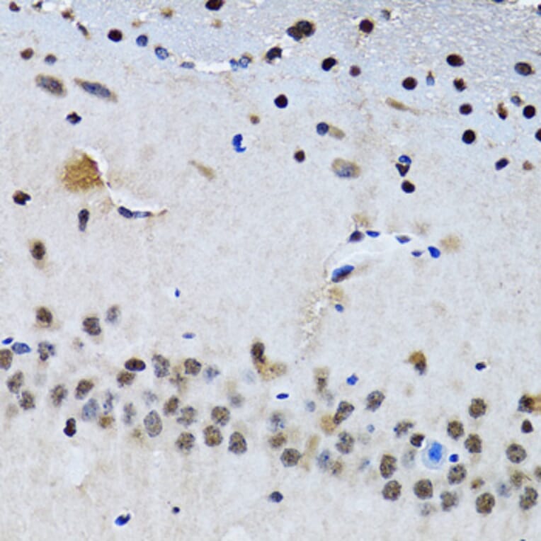 Immunohistochemistry - Anti-Livin Antibody (A89372) - Antibodies.com