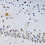 Immunohistochemistry - Anti-Livin Antibody (A89372) - Antibodies.com