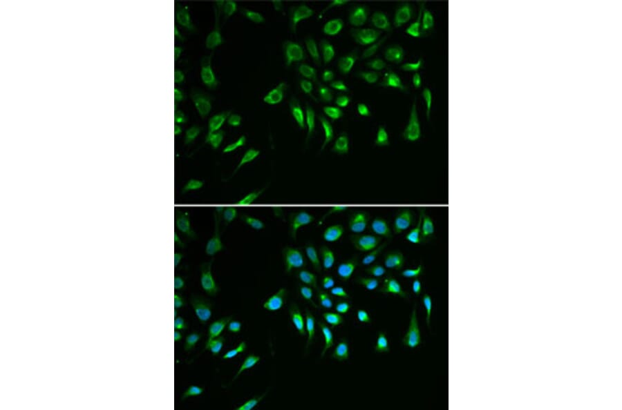 Immunofluorescence - Anti-Livin Antibody (A89372) - Antibodies.com
