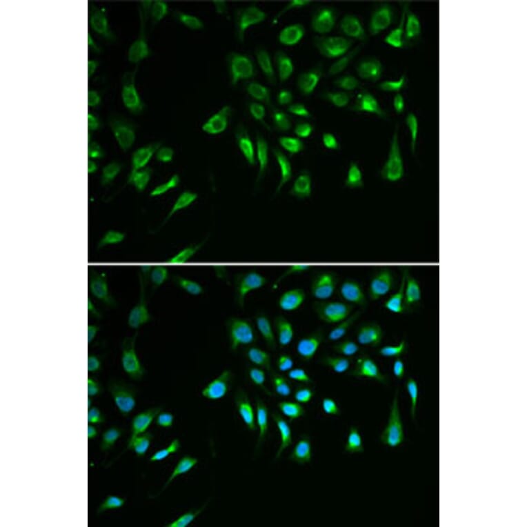 Immunofluorescence - Anti-Livin Antibody (A89372) - Antibodies.com
