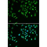 Immunofluorescence - Anti-Livin Antibody (A89372) - Antibodies.com