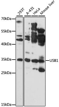 Western blot analysis of extracts of various cell lines, using Anti-USB1 Antibody (A13229) at 1:3000 dilution.
Secondary antibody: Goat Anti-Rabbit IgG (H+L) (HRP) (AS014) at 1:10,000 dilution.
Lysates / proteins: 25µg per lane.
Blocking buffer: 3% non-fat dry milk in TBST.
Detection: ECL Basic Kit (RM00020).
Exposure time: 180s.