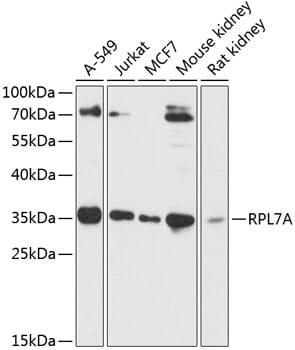 Western blot analysis of extracts of various cell lines, using Anti-RPL7A Antibody (A14060) at 1:3000 dilution.
Secondary antibody: Goat Anti-Rabbit IgG (H+L) (HRP) (AS014) at 1:10,000 dilution.
Lysates / proteins: 25µg per lane.
Blocking buffer: 3% non-fat dry milk in TBST.
Detection: ECL Basic Kit (RM00020).
Exposure time: 60s.