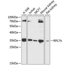 Western Blot - Anti-RPL7A Antibody (A89374) - Antibodies.com