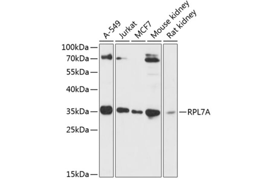 Western Blot - Anti-RPL7A Antibody (A89374) - Antibodies.com