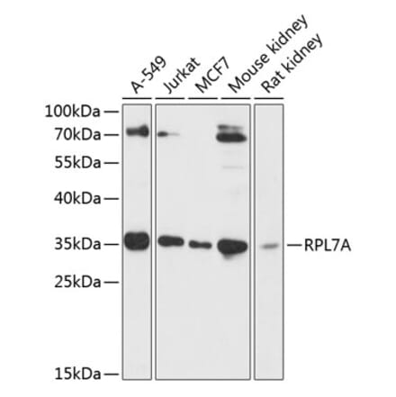 Western Blot - Anti-RPL7A Antibody (A89374) - Antibodies.com