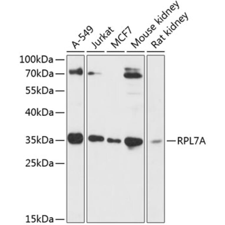 Western Blot - Anti-RPL7A Antibody (A89374) - Antibodies.com