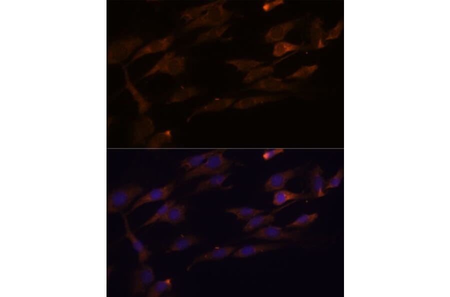 Immunofluorescence - Anti-RPL7A Antibody (A89374) - Antibodies.com