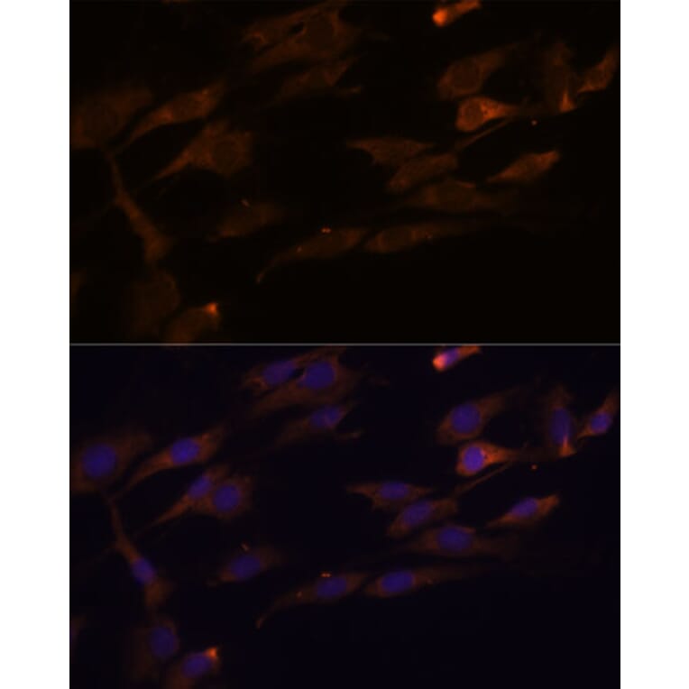 Immunofluorescence - Anti-RPL7A Antibody (A89374) - Antibodies.com