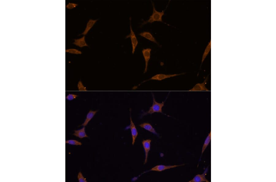 Immunofluorescence - Anti-RPL7A Antibody (A89374) - Antibodies.com