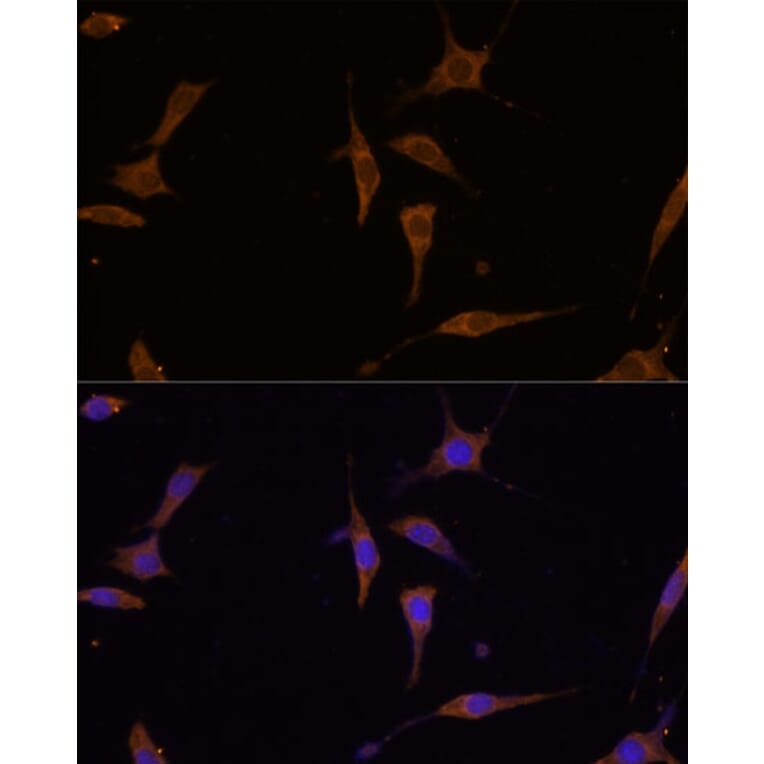 Immunofluorescence - Anti-RPL7A Antibody (A89374) - Antibodies.com