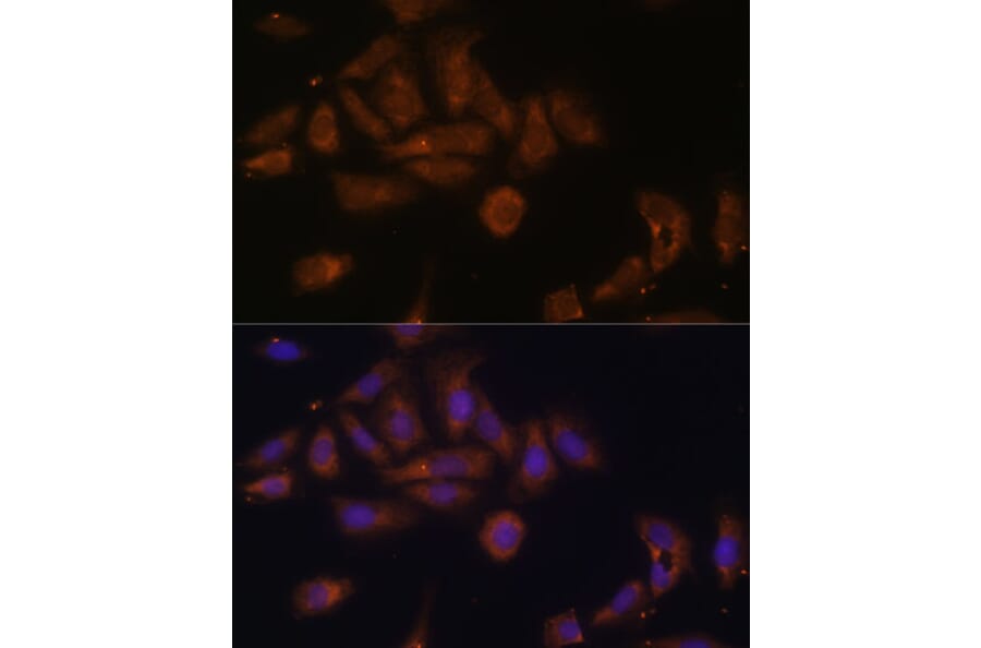 Immunofluorescence - Anti-RPL7A Antibody (A89374) - Antibodies.com