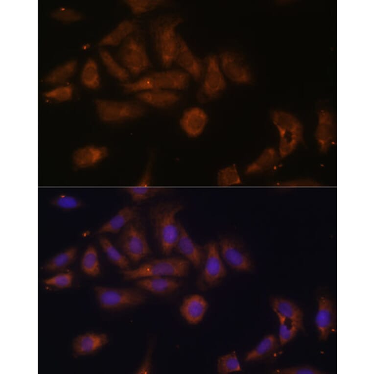 Immunofluorescence - Anti-RPL7A Antibody (A89374) - Antibodies.com