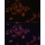 Immunofluorescence - Anti-RPL7A Antibody (A89374) - Antibodies.com