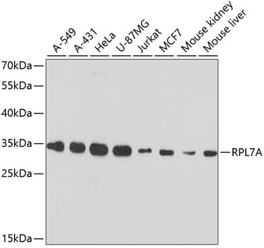 Western blot analysis of extracts of various cell lines, using Anti-RPL7A Antibody (A13713) at 1:3000 dilution.
Secondary antibody: Goat Anti-Rabbit IgG (H+L) (HRP) (AS014) at 1:10,000 dilution.
Lysates / proteins: 25µg per lane.
Blocking buffer: 3% non-fat dry milk in TBST.
Detection: ECL Basic Kit (RM00020).
Exposure time: 90s.