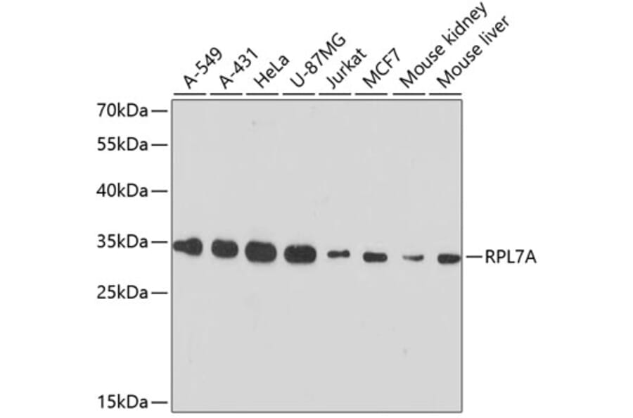 Western Blot - Anti-RPL7A Antibody (A89375) - Antibodies.com