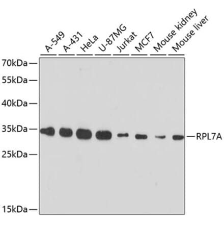 Western Blot - Anti-RPL7A Antibody (A89375) - Antibodies.com