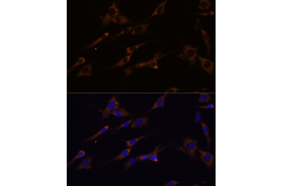 Immunofluorescence - Anti-RPL7A Antibody (A89375) - Antibodies.com