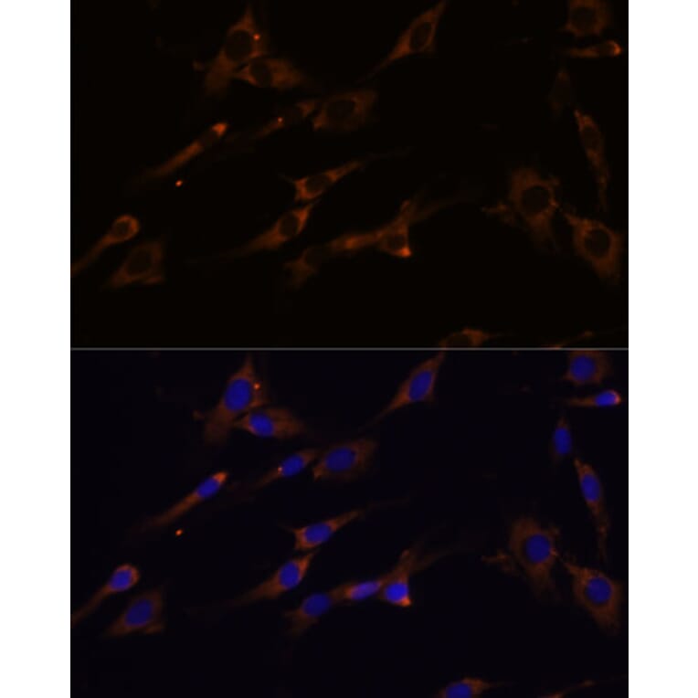 Immunofluorescence - Anti-RPL7A Antibody (A89375) - Antibodies.com