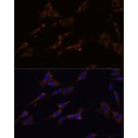 Immunofluorescence - Anti-RPL7A Antibody (A89375) - Antibodies.com