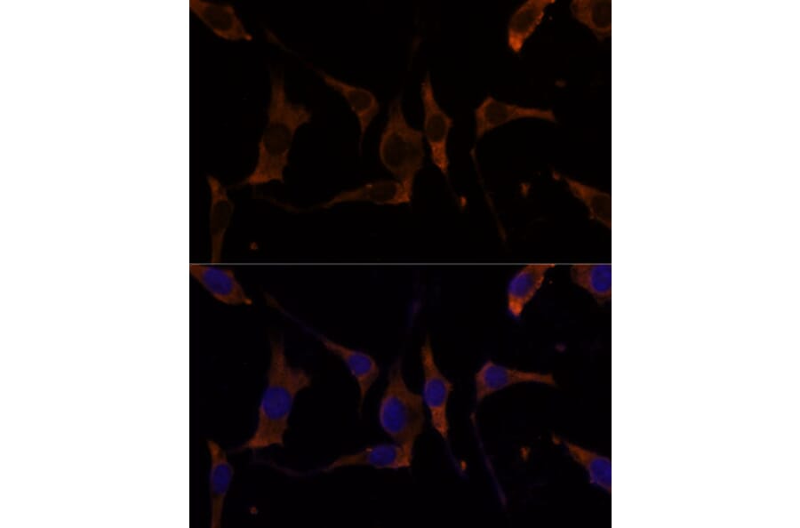 Immunofluorescence - Anti-RPL7A Antibody (A89375) - Antibodies.com