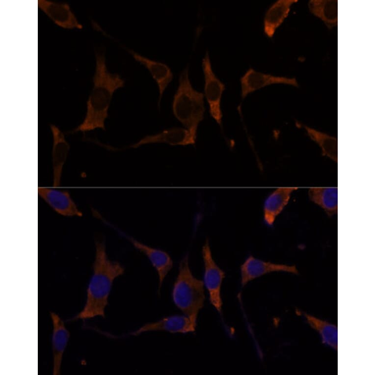 Immunofluorescence - Anti-RPL7A Antibody (A89375) - Antibodies.com