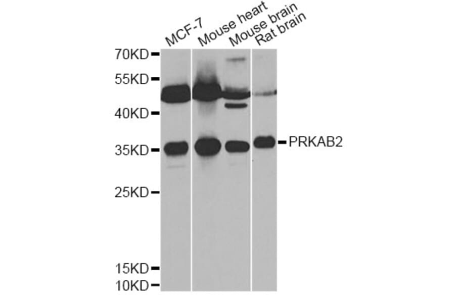 Western Blot - Anti-PRKAB2 Antibody (A13341) - Antibodies.com
