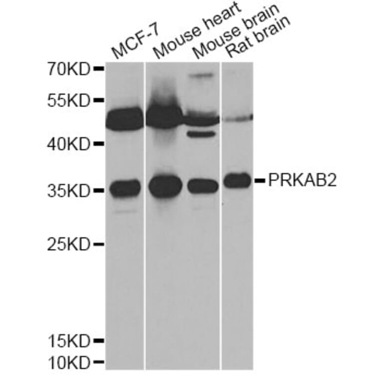 Western Blot - Anti-PRKAB2 Antibody (A13341) - Antibodies.com