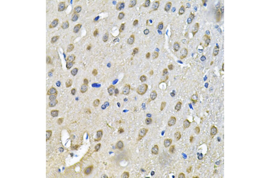 Immunohistochemistry - Anti-PRKAB2 Antibody (A13341) - Antibodies.com