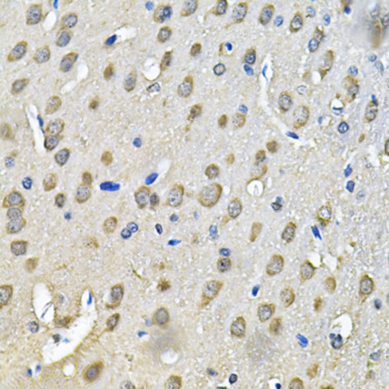 Immunohistochemistry - Anti-PRKAB2 Antibody (A13341) - Antibodies.com
