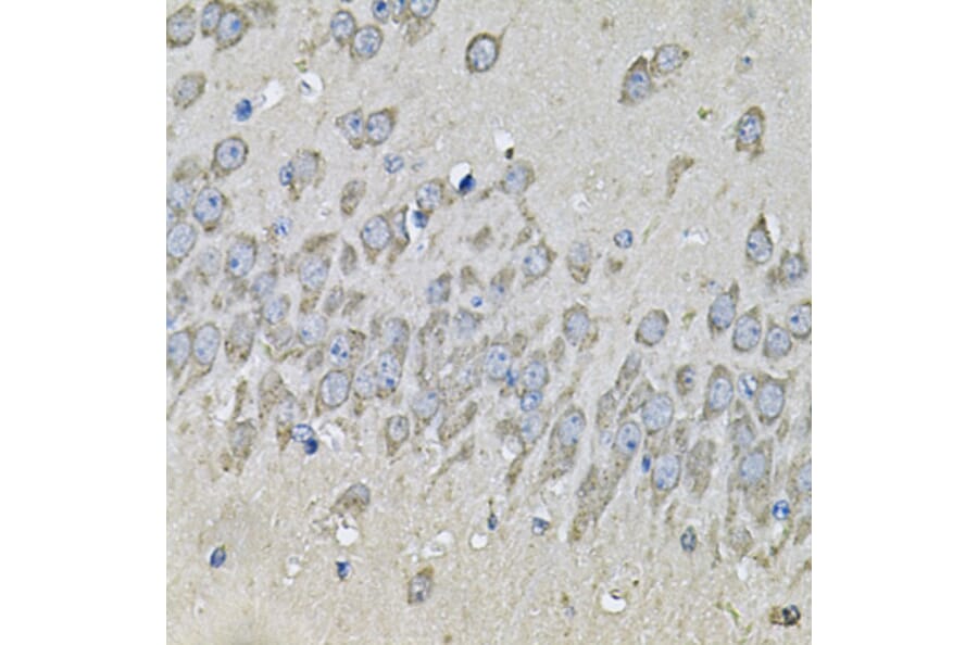 Immunohistochemistry - Anti-PRKAB2 Antibody (A13341) - Antibodies.com