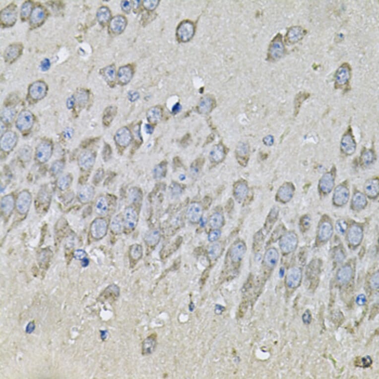 Immunohistochemistry - Anti-PRKAB2 Antibody (A13341) - Antibodies.com
