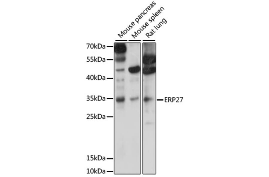 Western Blot - Anti-ERP27 Antibody (A89377) - Antibodies.com
