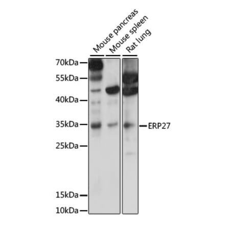 Western Blot - Anti-ERP27 Antibody (A89377) - Antibodies.com
