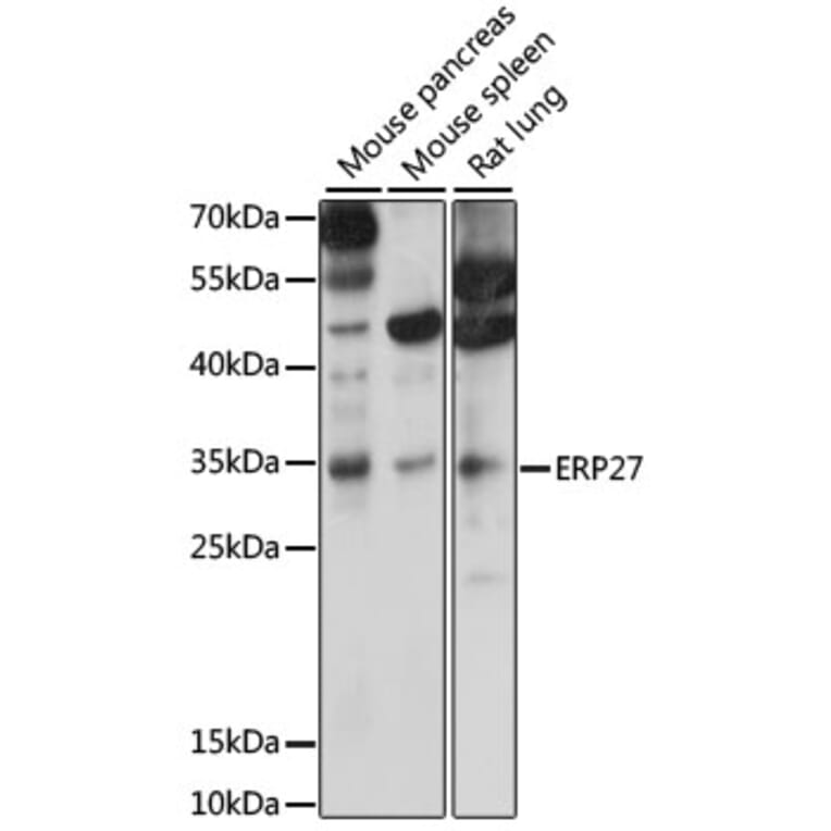 Western Blot - Anti-ERP27 Antibody (A89377) - Antibodies.com