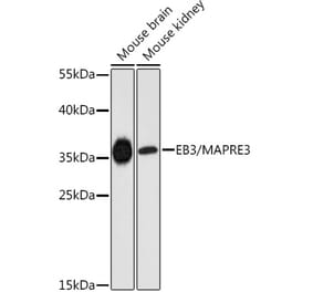Western Blot - Anti-EB3 Antibody (A89378) - Antibodies.com