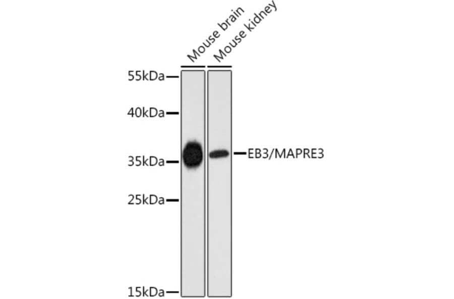 Western Blot - Anti-EB3 Antibody (A89378) - Antibodies.com