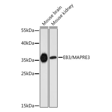 Western Blot - Anti-EB3 Antibody (A89378) - Antibodies.com