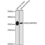 Western Blot - Anti-EB3 Antibody (A89378) - Antibodies.com