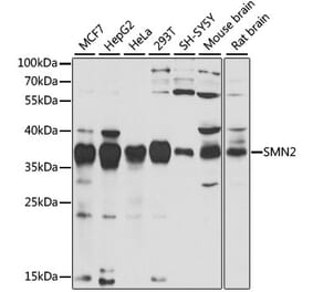 Western Blot - Anti-SMN/Gemin 1 Antibody (A89379) - Antibodies.com