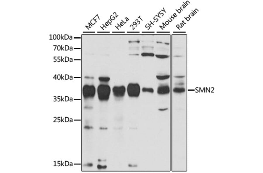 Western Blot - Anti-SMN/Gemin 1 Antibody (A89379) - Antibodies.com
