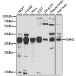 Western Blot - Anti-SMN/Gemin 1 Antibody (A89379) - Antibodies.com