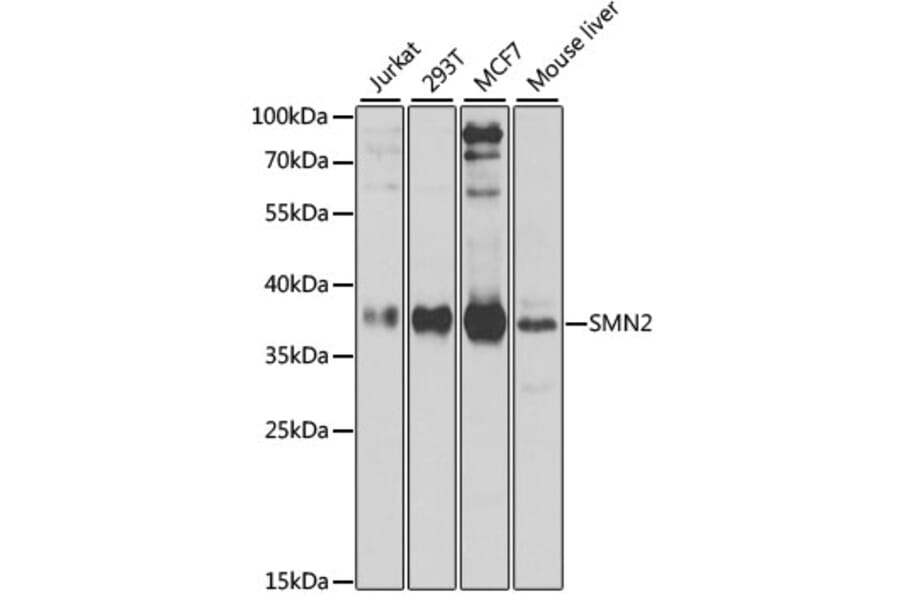Western Blot - Anti-SMN/Gemin 1 Antibody (A89379) - Antibodies.com