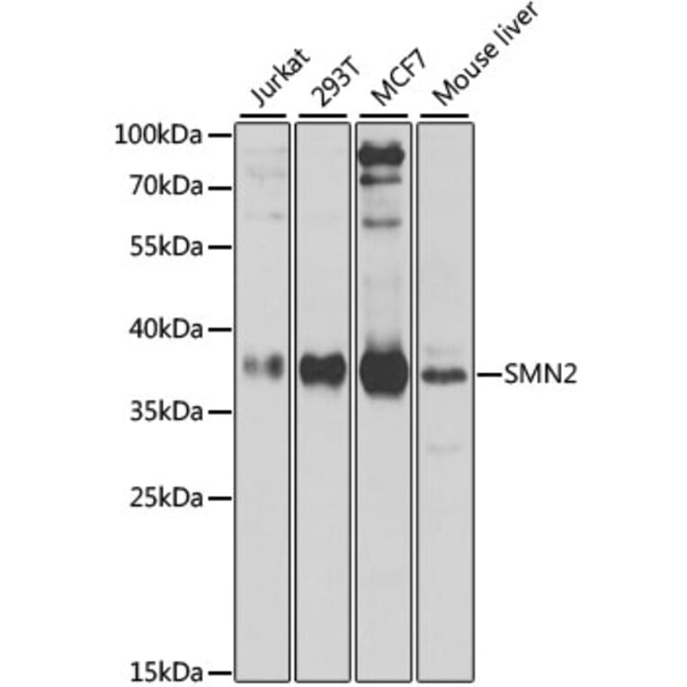 Western Blot - Anti-SMN/Gemin 1 Antibody (A89379) - Antibodies.com