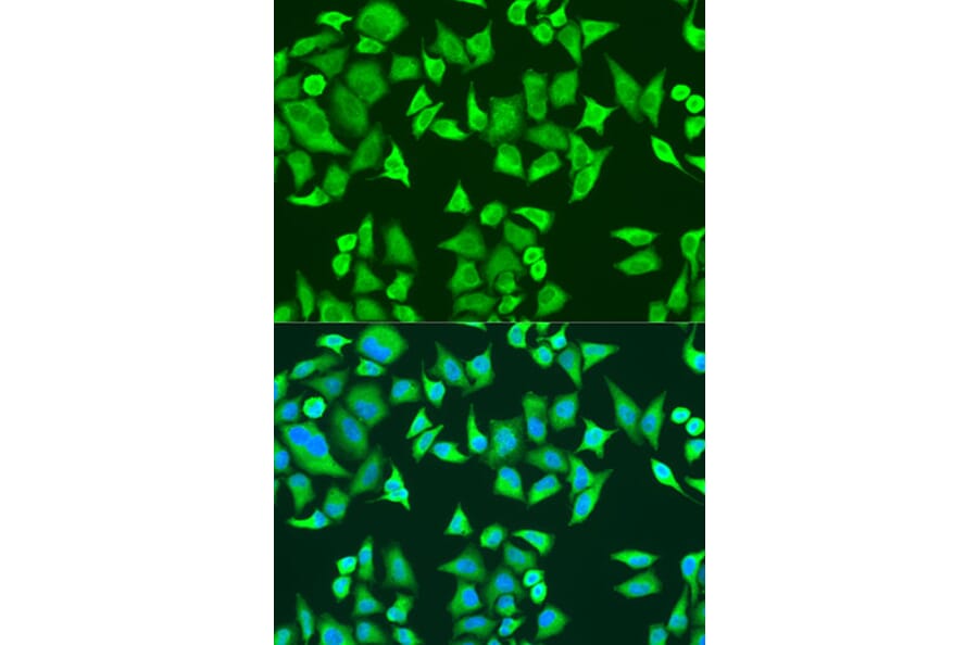 Immunofluorescence - Anti-SMN/Gemin 1 Antibody (A89379) - Antibodies.com