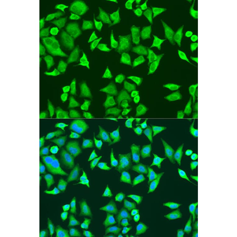 Immunofluorescence - Anti-SMN/Gemin 1 Antibody (A89379) - Antibodies.com