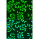 Immunofluorescence - Anti-SMN/Gemin 1 Antibody (A89379) - Antibodies.com