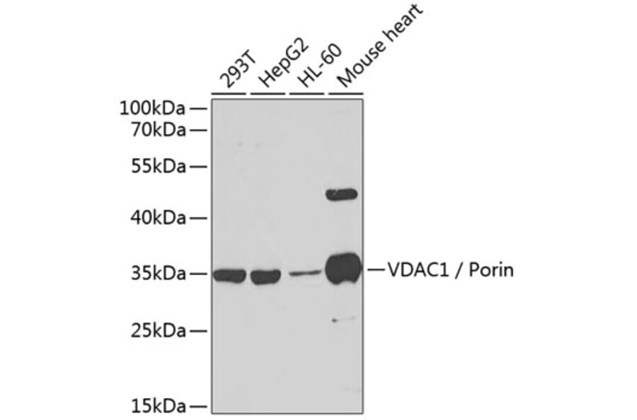 Western Blot - Anti-VDAC1 / Porin Antibody (A89380) - Antibodies.com