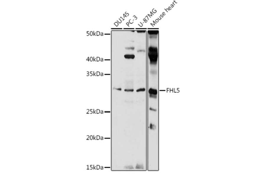Western Blot - Anti-ACT Antibody (A89381) - Antibodies.com