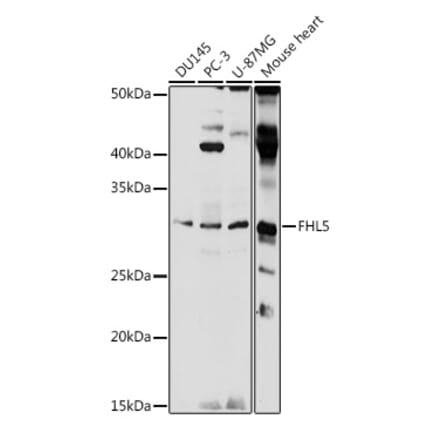 Western Blot - Anti-ACT Antibody (A89381) - Antibodies.com